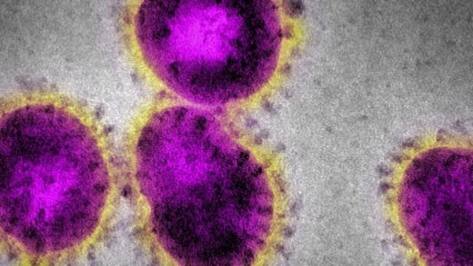 primo morto di coronavirus in provincia di Macerata: è una donna di Porto Recanati molecola corona virus