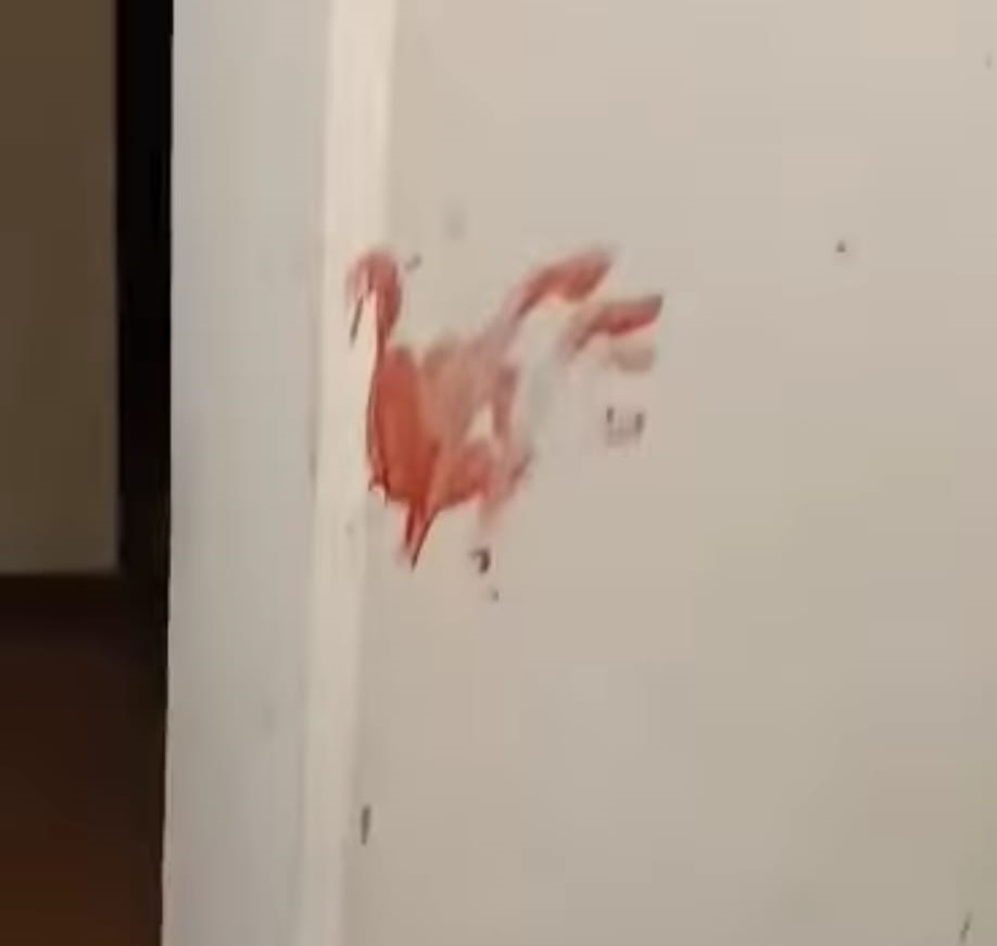 Porto Recanati, operaio aggredito con una spranga: sospetto regolamento di conti