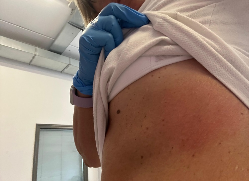 Soccorritrice aggredita in ambulanza da un paziente mentre era diretta a Civitanova Marche